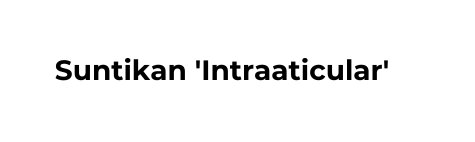 Suntikan Intraaticular